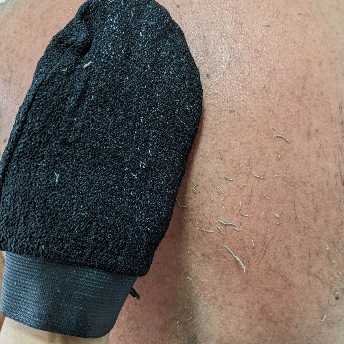 The glove on a shoulder, dead skin rolling away