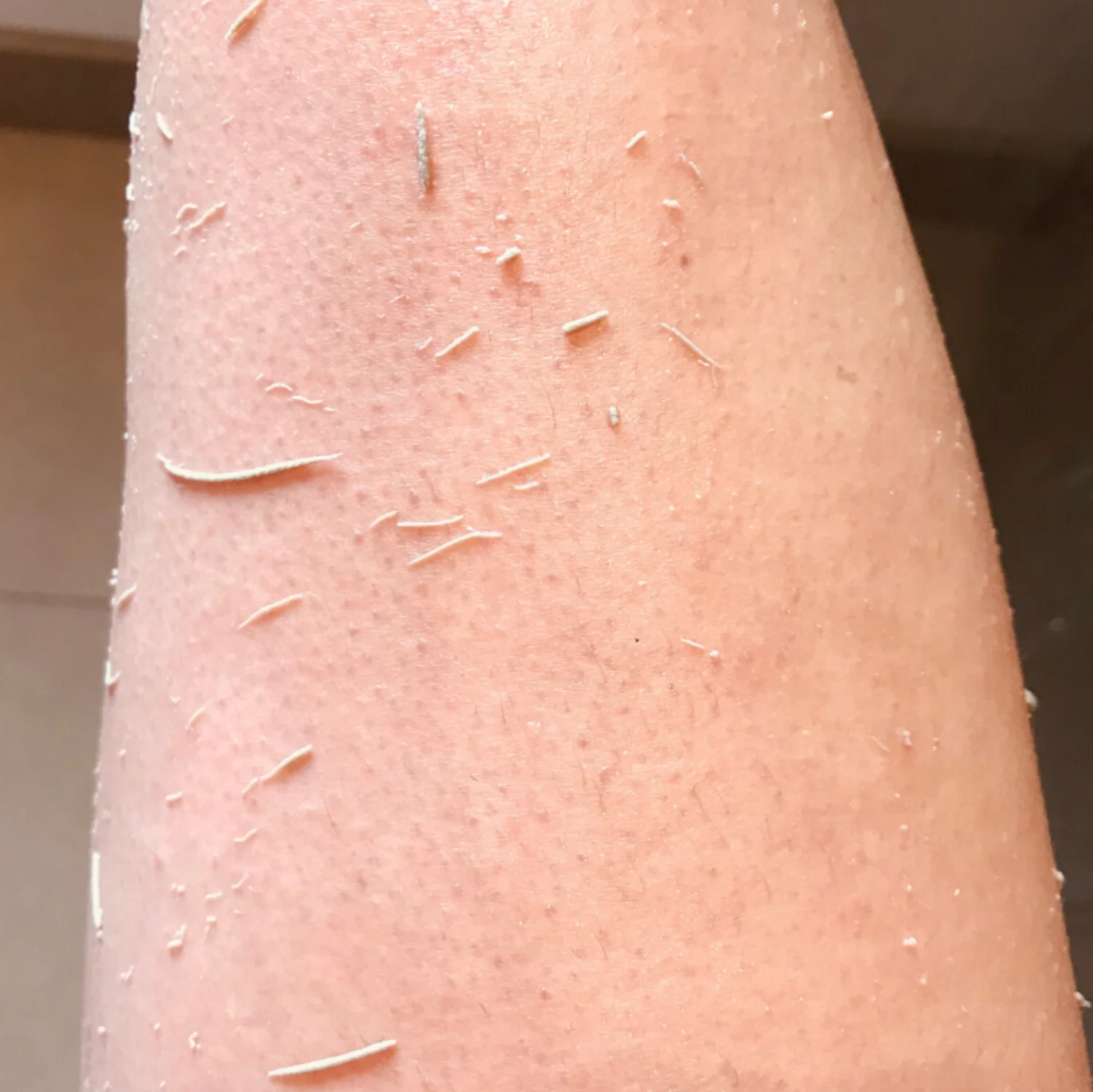 Dead skin lifted from a shin after scrubbing