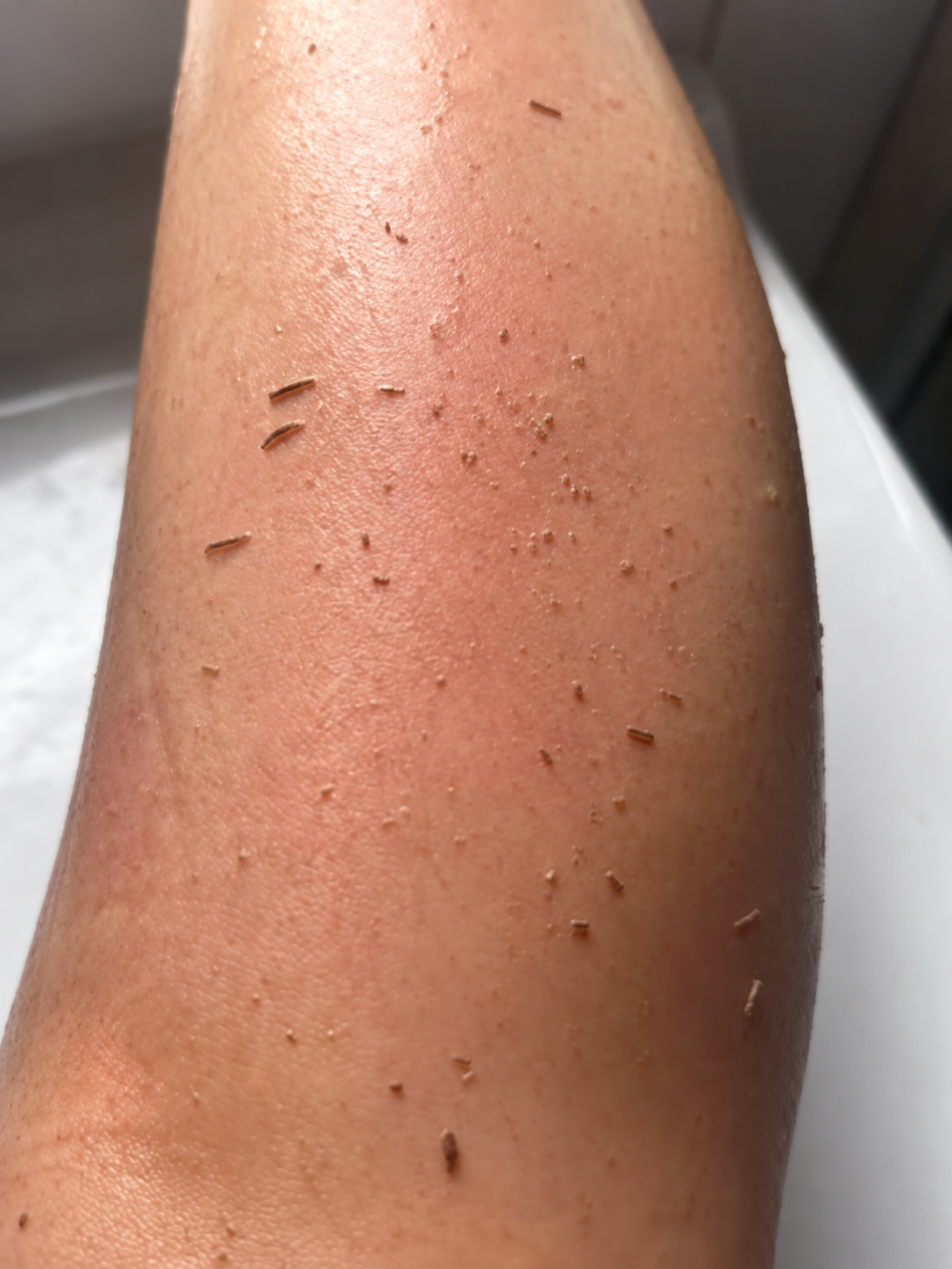 Dead skin lifted from a forearm after scrubbing