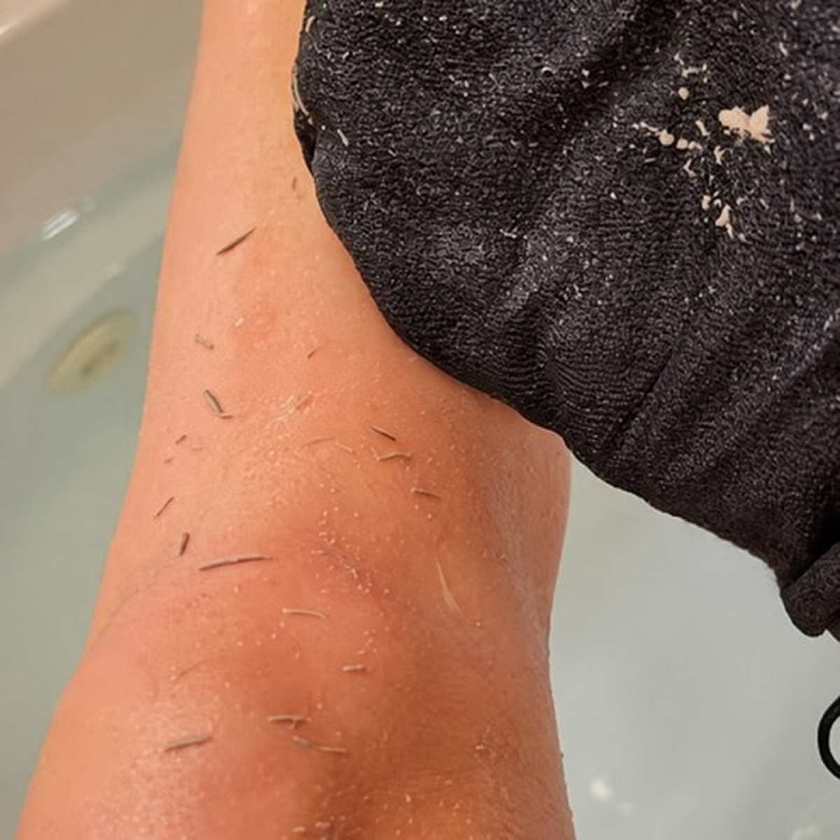 Dead skin on the glove and the leg, at the edge of the bath