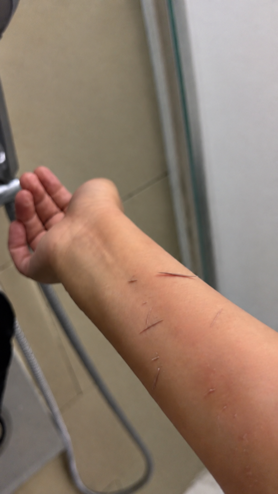 Dead skin lifted from a forearm in the shower